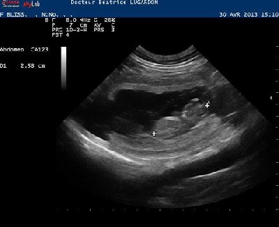 Secret de Lune - Gestation confirmée